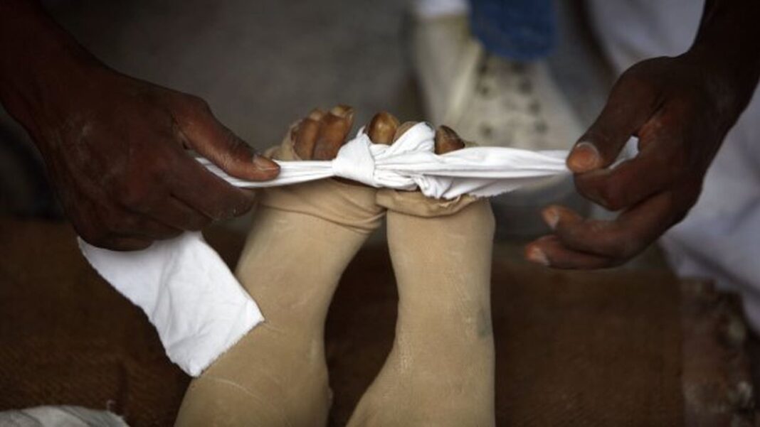 Manos de piel oscura atan un paño blanco alrededor de los tobillos de unas piernas vendadas con material beige, con los dedos de los pies visibles al fondo.